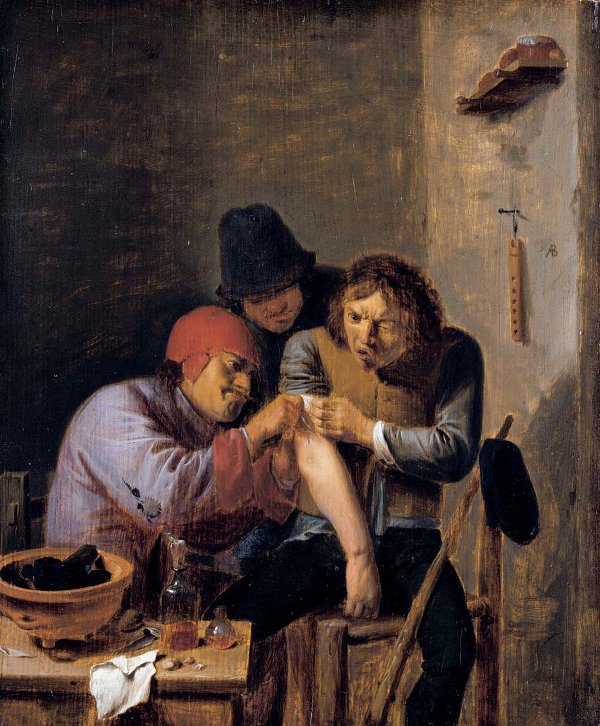 Fig. 9 - Il salasso (opera di A. Brouwer, 1605-1638) costituiva il rimedio principale anche per il catarro